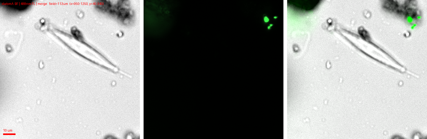 Empty frustule: no fluorescence while neighbours glow