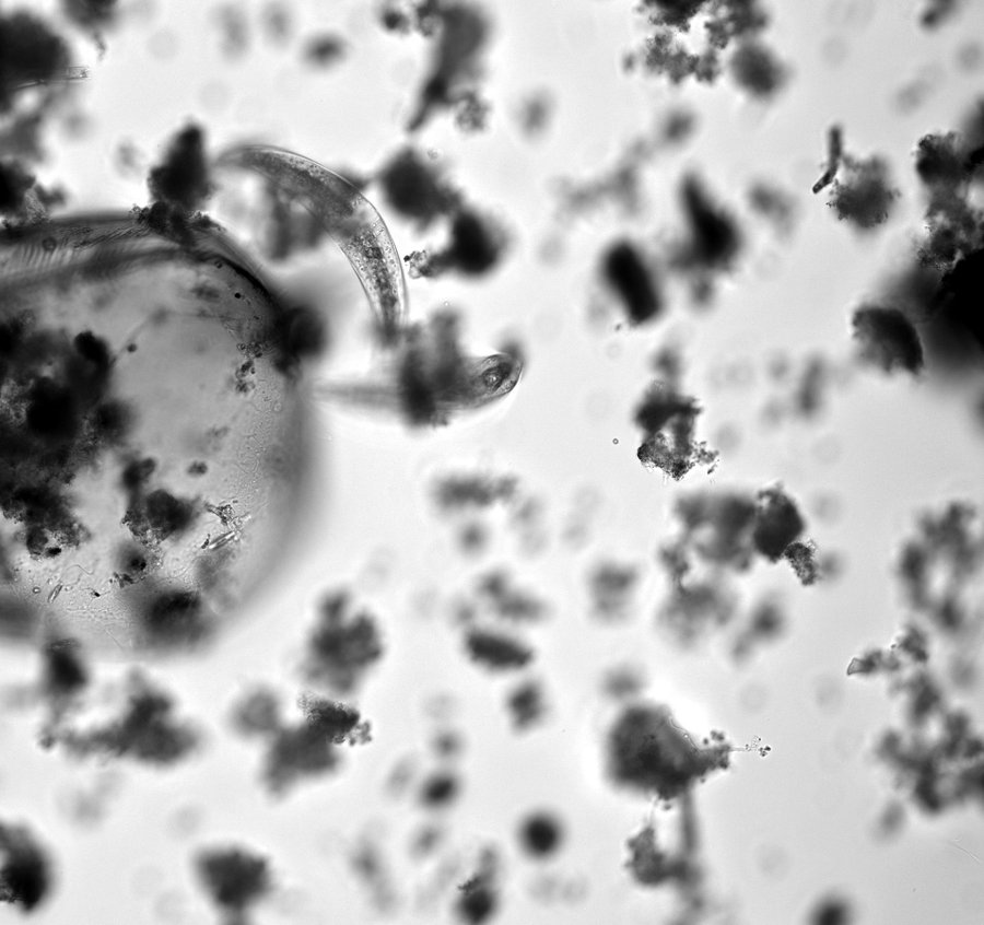 Brightfield micrograph showing an organism among debris